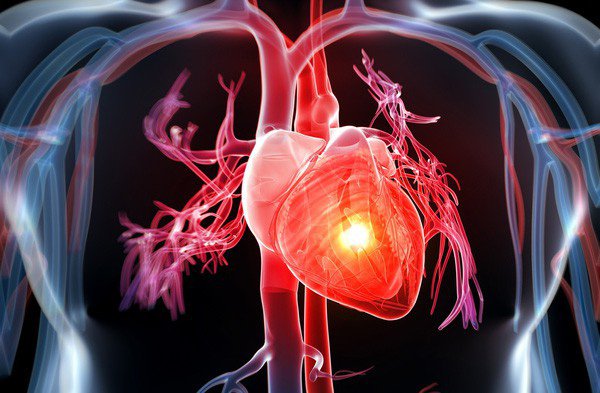isoflavon mầm đậu nành ngăn ngừa bệnh tim mạch, isoflavon ngăn ngừa bệnh tim mạch, isoflavon và bệnh tim mạch, isoflavon có tác dụng gì với bệnh tim mạch, isoflavon phòng bệnh tim mạch, isoflavon mầm đậu nành phòng ngừa bệnh tim mạch