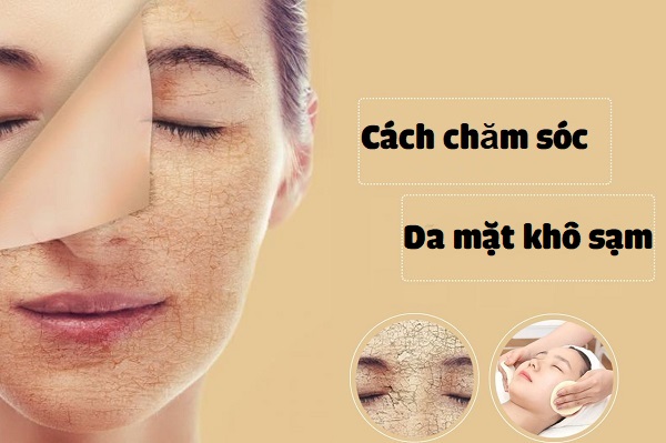 Cách chăm sóc da mặt khô sạm, da măt khô phai lam sao, da mặt bị khô phải làm sao, cách chữa da mặt khô, cách cải thiện da mặt khô, cách làm da mặt hết khô sần